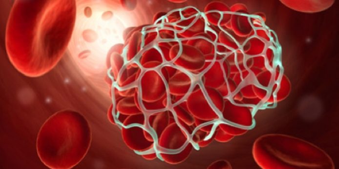 Angiom-Koeln-Operation