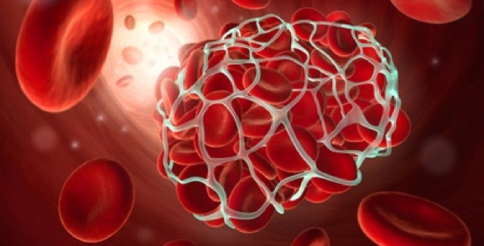HIrnblutung-Angiom-Neurochirurgie-Siegen