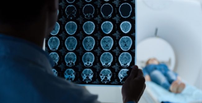 Hirntumor-Koeln-operieren