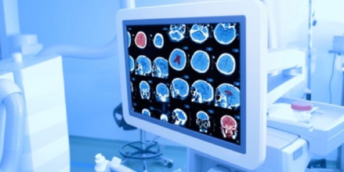 Koeln-OP-Hirntumor-operieren