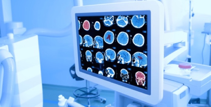 Koeln-OP-Hirntumor-operieren