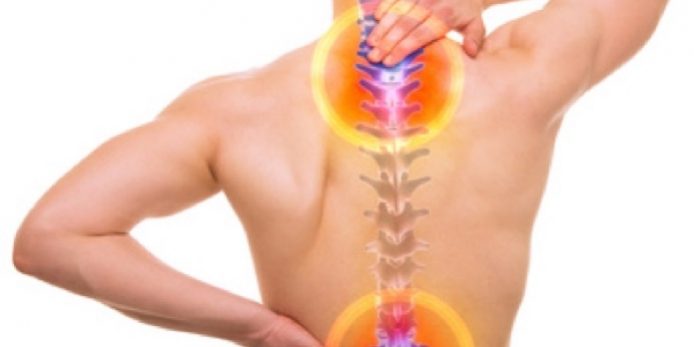 Neuro Wirbelsäule Rücken Bonn