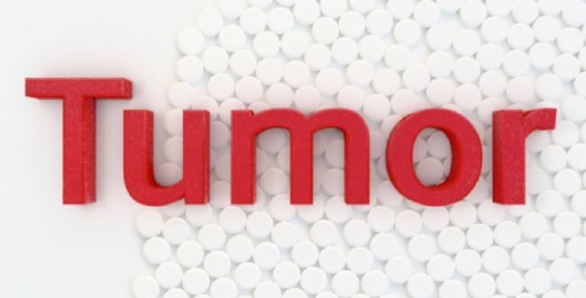 Tumor-Hirn-OP-Behandlung-Therapie-Siegen-1