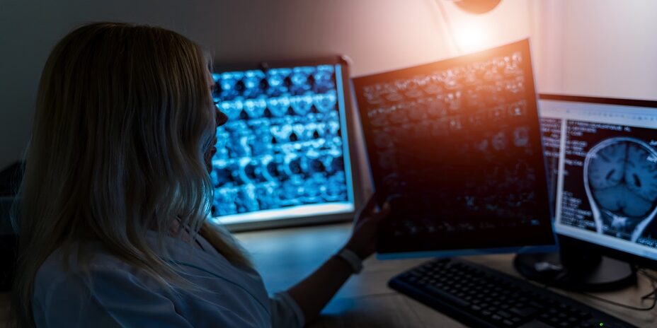 Neurochirurg für Bonn: OP nach Jannetta bei Senioren?