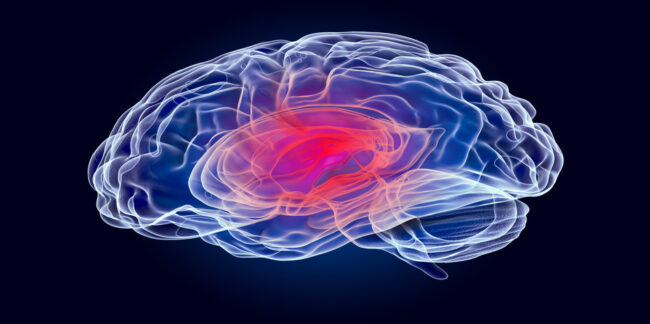 Hirntumor: Studie zeigt, Viren können Gliom verkleinern Hirntumor: Studie zeigt, Viren können Gliom verkleinern