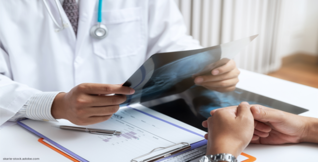 arteriovenoese-malformation-behandeln-oder-nicht Auf dem Bild sieht man einen Arzt, welcher ein Röntgenbild eines Kopfes in den Händen hält. Er scheint dieses seinem Patienten zu erklären.